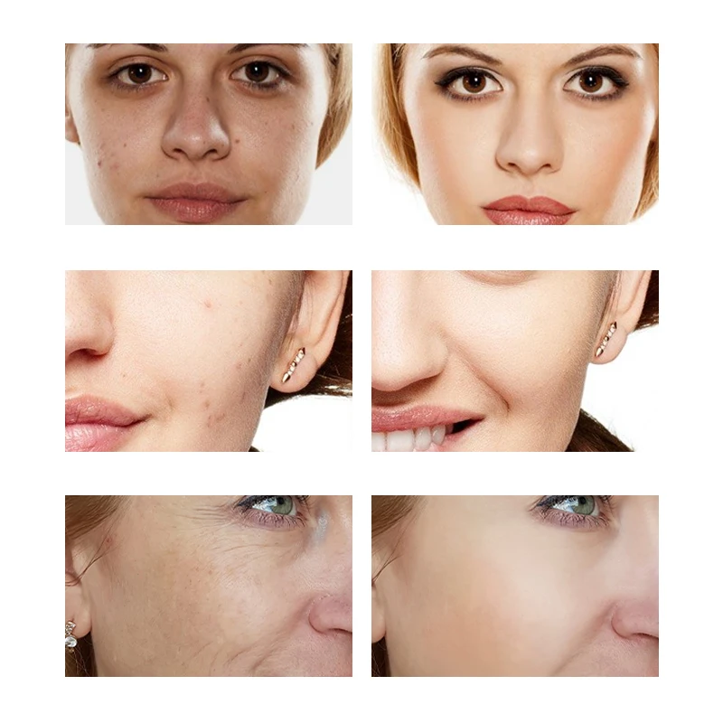 OEM/ODM Private Label Skin Care Moisturizing Anti Wrinkle Vitamin C Serum Collagen Hyaluronic Acid Repair Serum