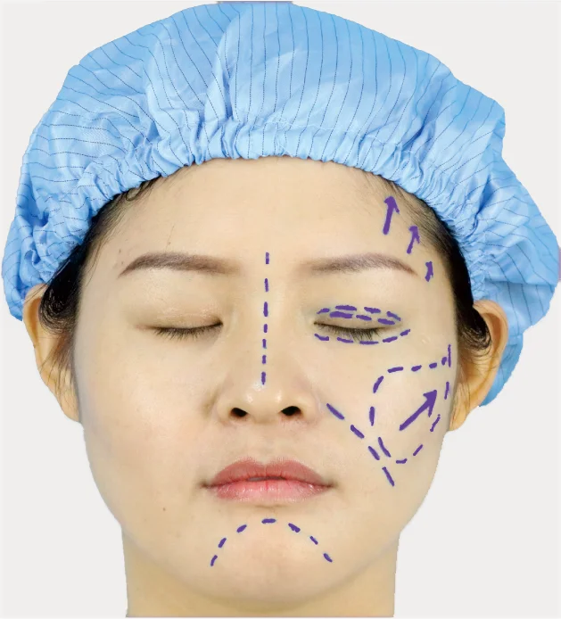 Permanent Waterproof Supply Available Single Head Good Quality Skin Marker Pen