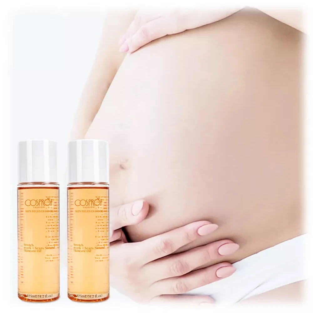 New Product Skin Regenerate Oil Stretch Mark Oil For Pregnancy Scar Removal Skin Care