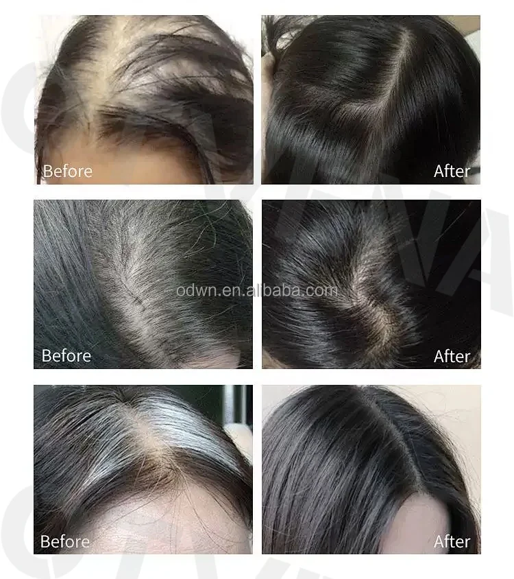 100% Natural Women Hair Treatment Oils 60ml Bulk Wholesale Best Effective for Hair Growth