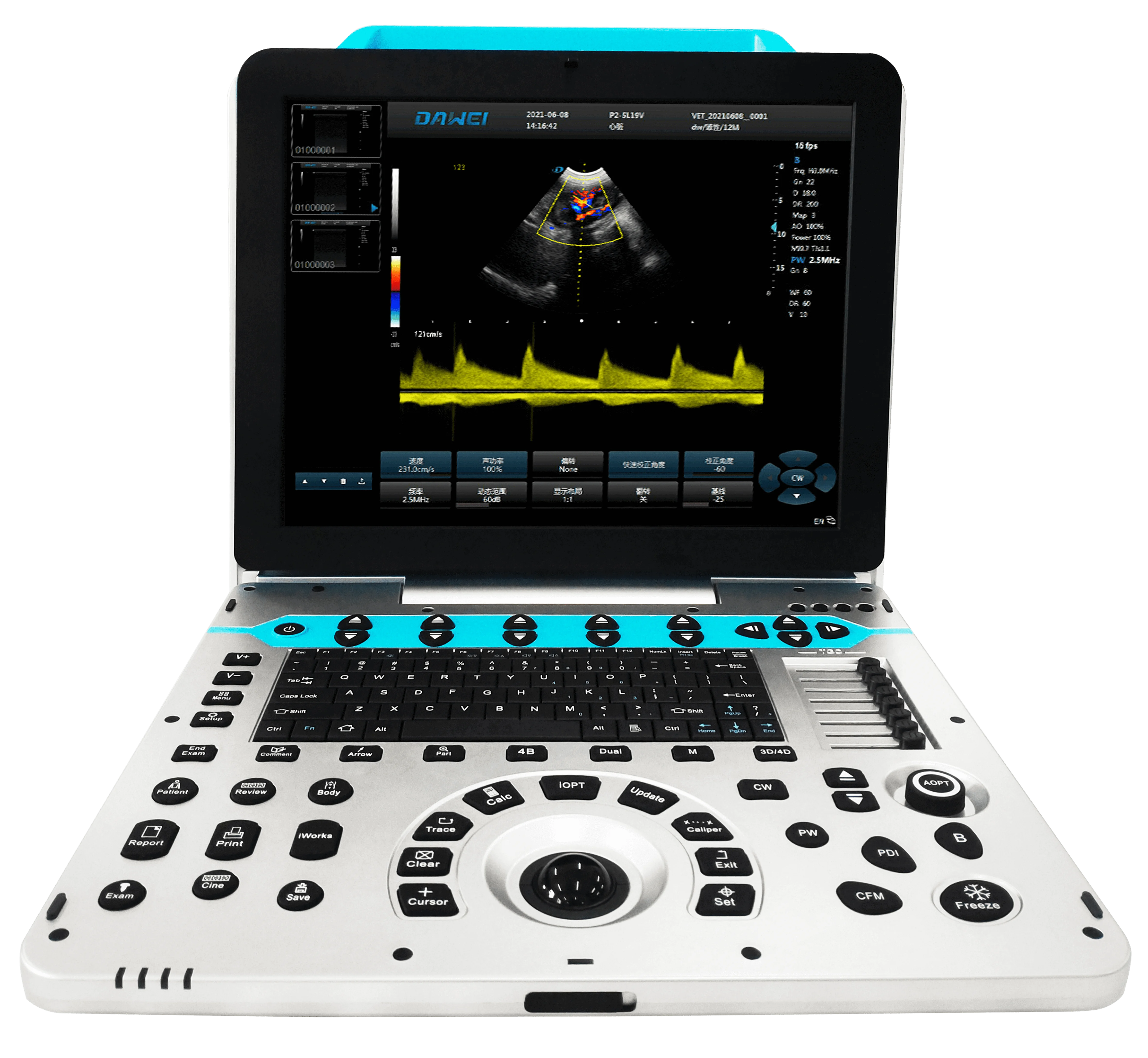 Dawei Veterinary Equipment Vet Full Digital Portable Ultrasound Scanner Machine For Animal