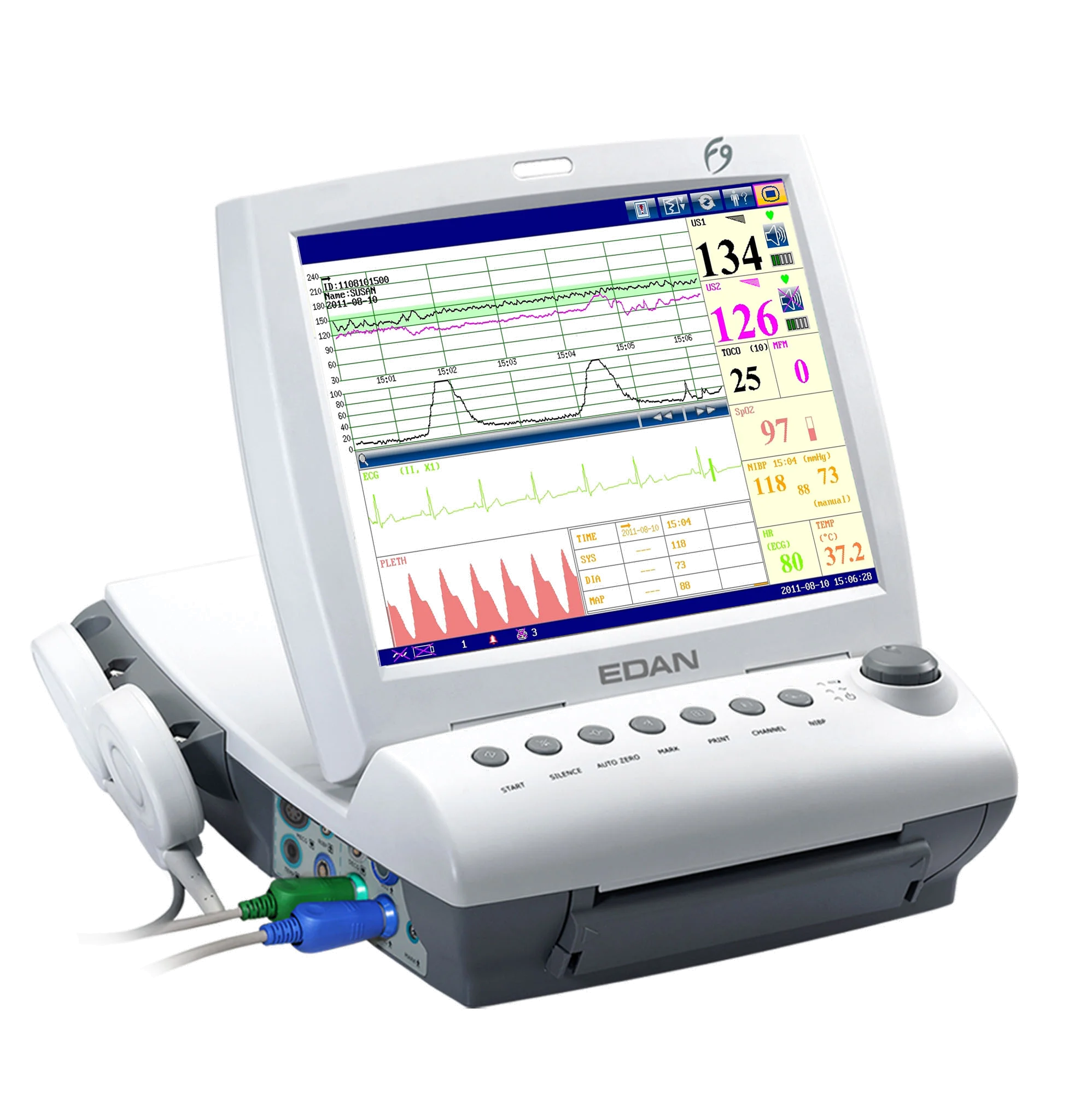OriginaEdan Fetal Monitor medical equipments Original Edan F9/F9 EXPRESS portable fetal doppler monitor for Infant Care with CE
