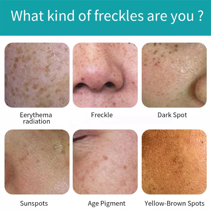 Moisturizing Cleanser Facial Skin Care Set Mask Whitening Anti Aging Cream Natural Lightening Serum For Face Care