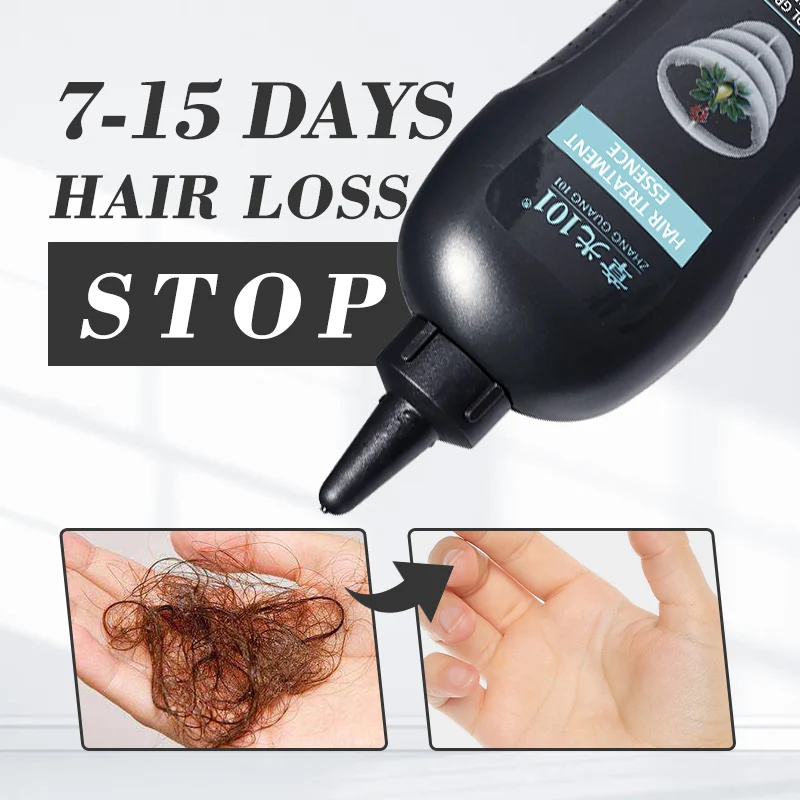 Top Rank Supplier Natural Alopecia Treatment Anti Hair Fall Oil