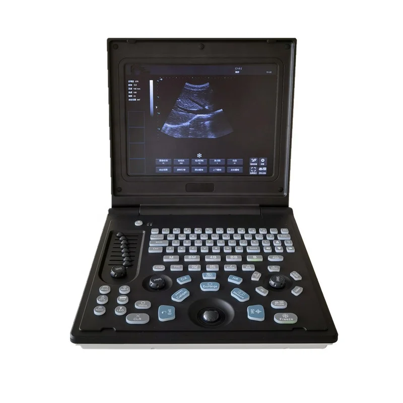 CHINCAN CK-2288Z Laptop Black and White Ultrasound Diagnostic System Ultrasound Scanner with probes