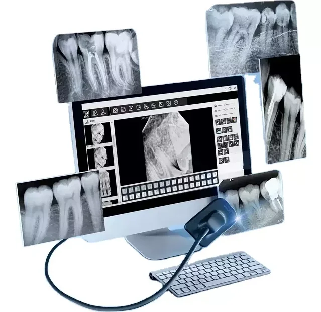 MDC63 изысканный дизайн Csl сцинтилятор RVG стоматологический рентгеновский датчик цена привлекательная для клиентов