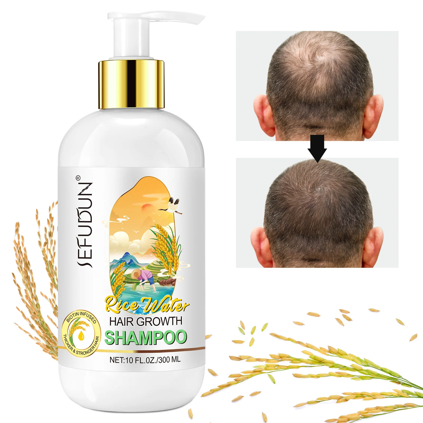 SEFUDUN private label deeply nourishing moisturizing natural organic anti hair loss biotin rice water hair growth shampoo