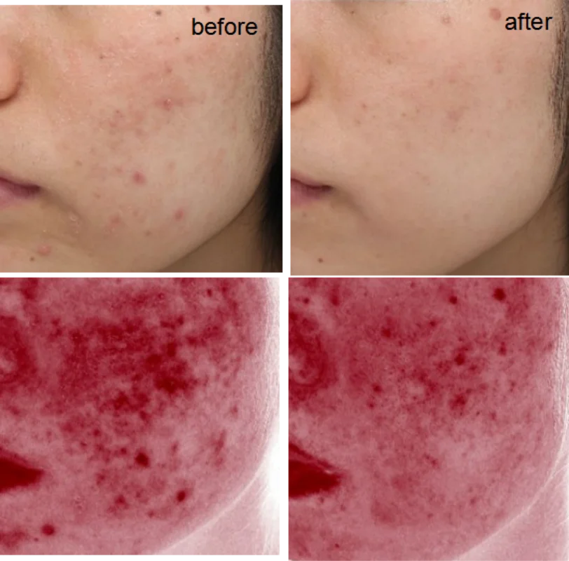 
Professional production active peptide recombinant human fgf1 powder 