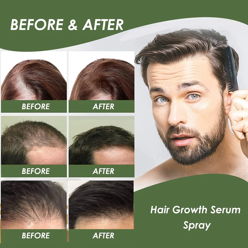 2022 regrow 7 day ginger germinal hair growth serum eelhoe ginger essential oil hair growth serum spray