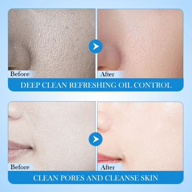 OEM FAYANKOU private label OEM natural skin care face wash whitening deep cleansing avocado facial cleanser Mousse