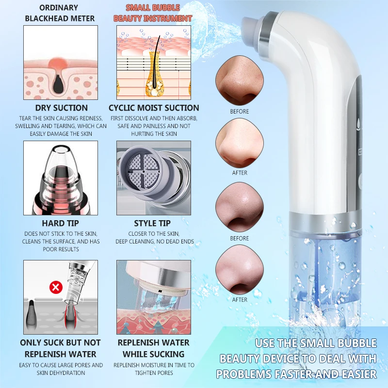 Small Pores Cleaner Bubble Blackhead Remover With Strong Vacuum Suction