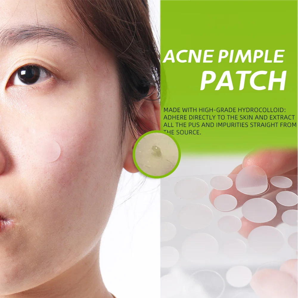 Wholesale Star Acne Dot Pimples Products For Treatment Dots Healing Patches