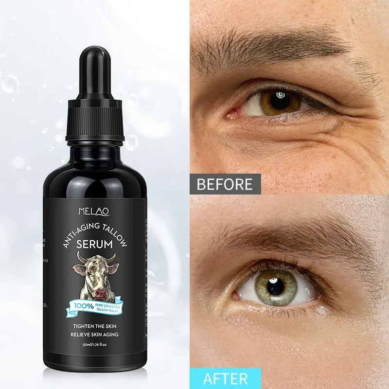 Anti Aging Moisturizing Best Serum for Men Face Lifting Serum Pore Shrinking Tallow Face Serum Face care