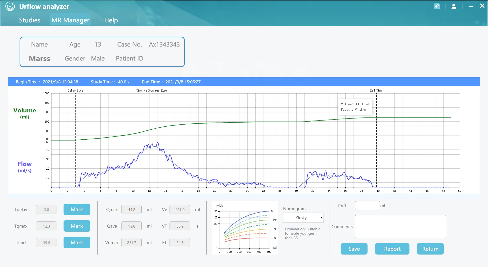Portable Intelligent Lab Use Uroflowmetry Equipment Uroflowmeter Uroflow Testing Machine