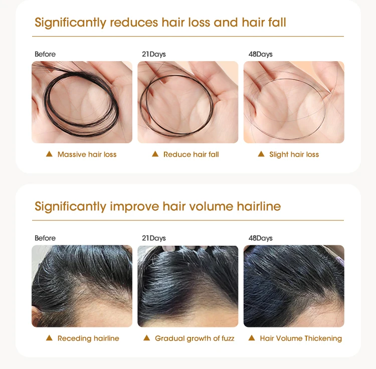 OCCA Custom 100% Natural Organic Private Label Essential Fast Hair Wild Growth Serum Rosemary Mint Oil For Black Women Men Kids