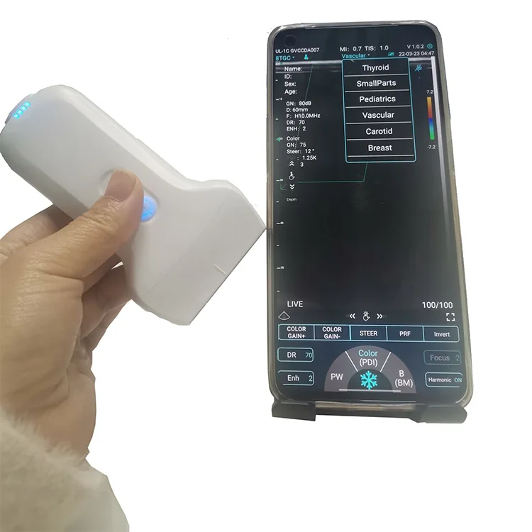 Multifunction 7.5/10mhz Portable Small Ultrasound Usb/wireless Linear Probe Price