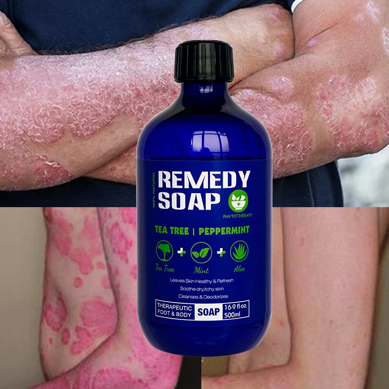 Private Label Natural Organic Body Wash Remedy Soap Rosemary Tea Tree Oil Healing Nourishing Shower Gel For Soothes Liquid Soap