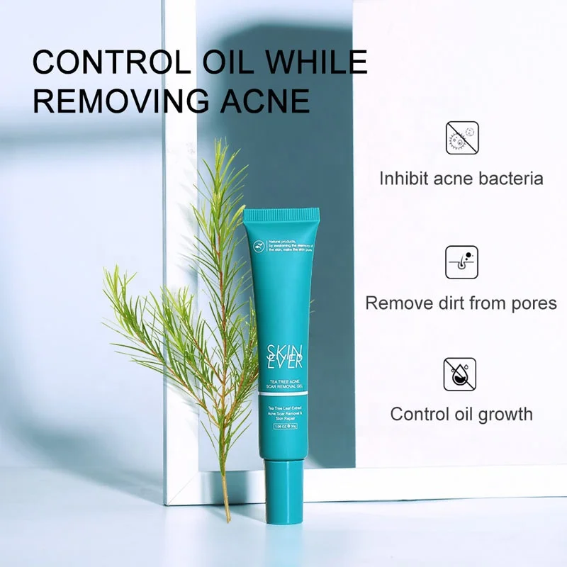 30g Acne Removal Freckle Cream Shrink Pores Whitening Moisturizing Oil Control Acne Cream Skin Care Treatment Face Cream