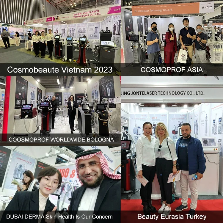 New Technology High Power Laser Diode 755 808 1064 nm Epilator Laser Hair Removal Machine