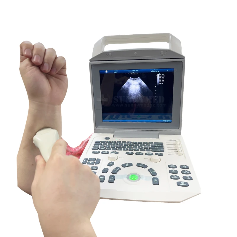 SYA-i50 BW system PW function 12.1-inch high resolution medical LED monitor 90 degrees rotation digital ultrasound