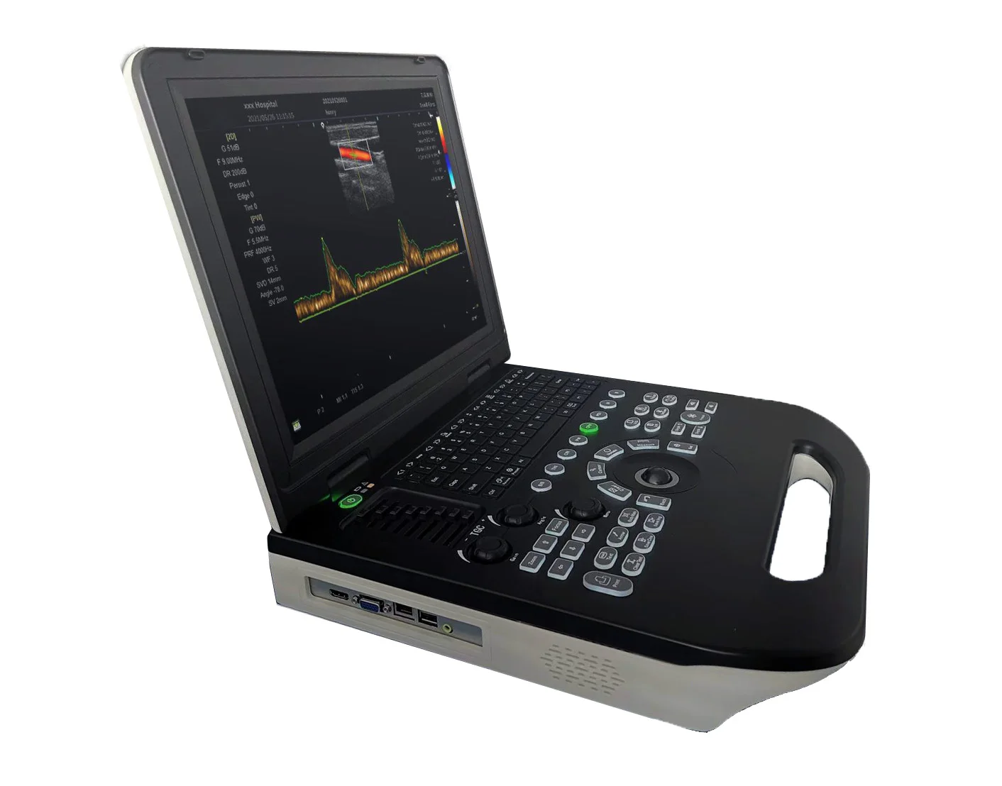 color doppler ultrasound machine ultrasound medical ultrasound instruments medical science medical supplies
