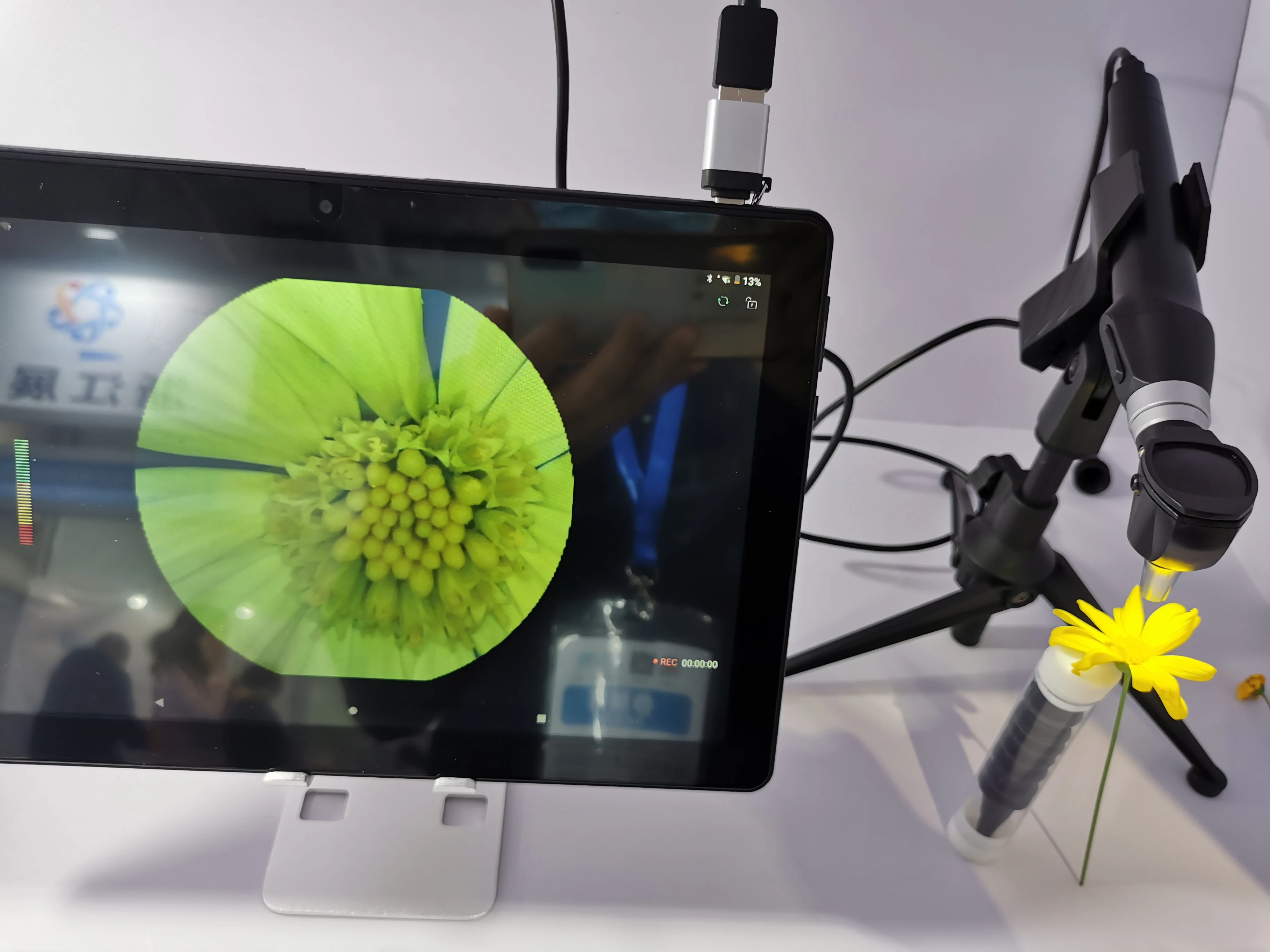 Video otoscope ENT Diagnostic Sets otoscope with usb connect Computers and Android phones