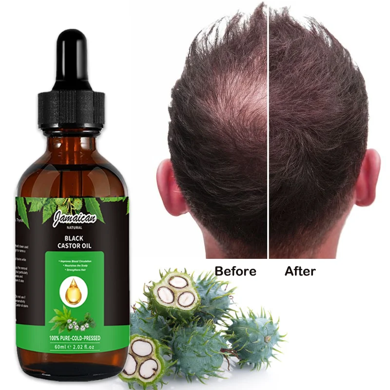 Factory Supplier Cold Pressed Skin Moisturizer Black Jamaican Castor Oil For Hair