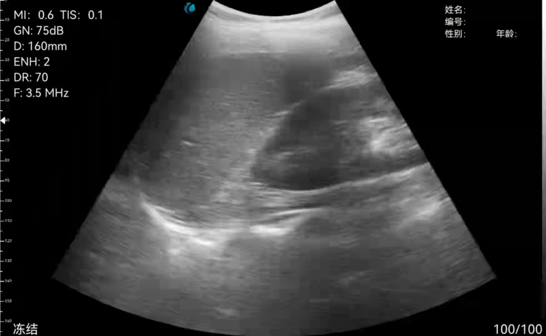 Medical Ultrasound Instruments portable  ultrasound sector scanner handheld  ultrasound machine