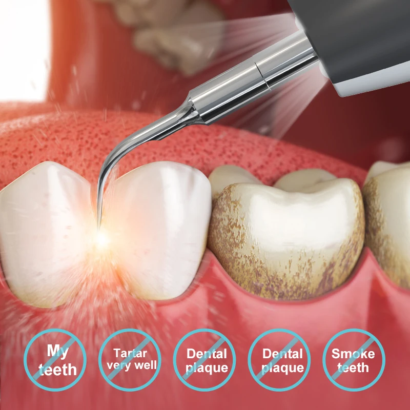 Home Use USB Rechargeable Teeth Deep Cleaning Ultrasonic Electric Oral Care Deep Teeth Cleaning Device about 2 Hours 500 Mah 1W