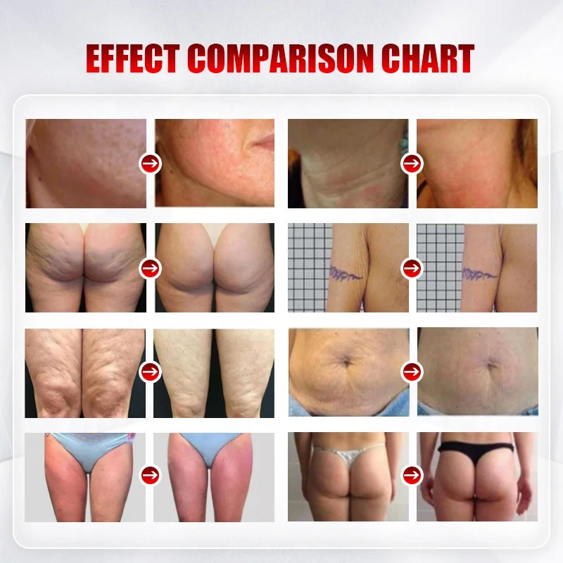 Free shipping in stock NEW ARRIVAL device rf skin tightening body slimming compression therapy machine lymphatic drainage