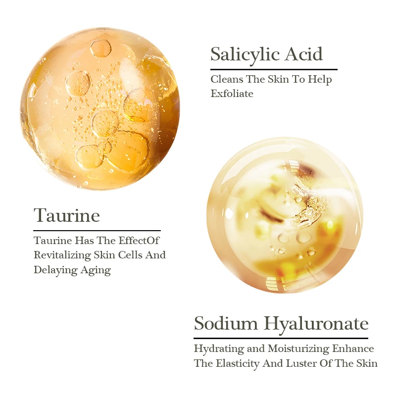 Oem Odm Organic Green And Yellow Peeling Oil Whitening Exfoliating Body Lotion For Stretch Marks