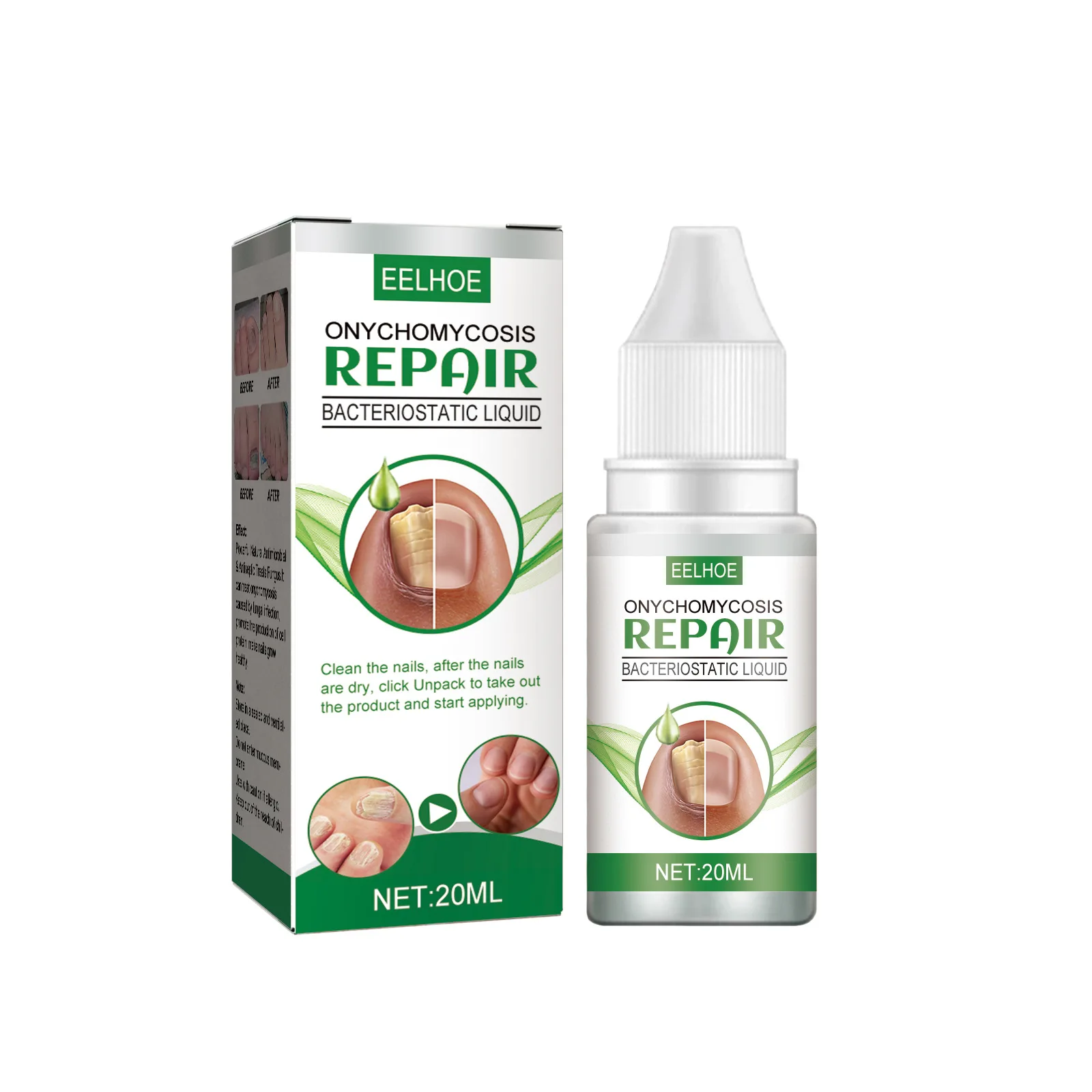 Hot Selling Hands and Feet Nail Onychomycosis Repair Finger Skin Care Treatments Cream