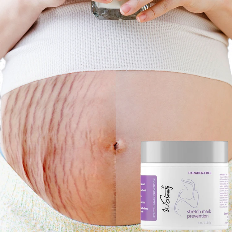 private label best natural organic body care moisturizing anti scar anti removal Stretch marks cream