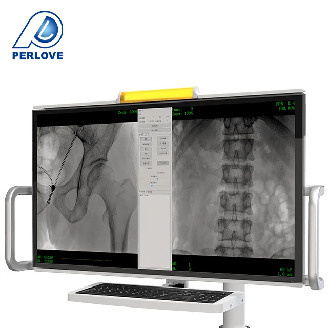 PLX119C мобильный цифровой рентгеноскопии Рукоятки C рентгеновский аппарат системы