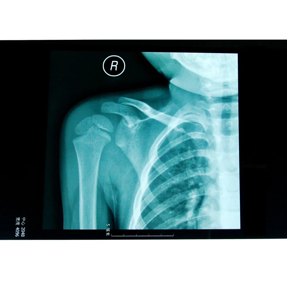 PET base blue sensitive medical dry film for hospital radiography department