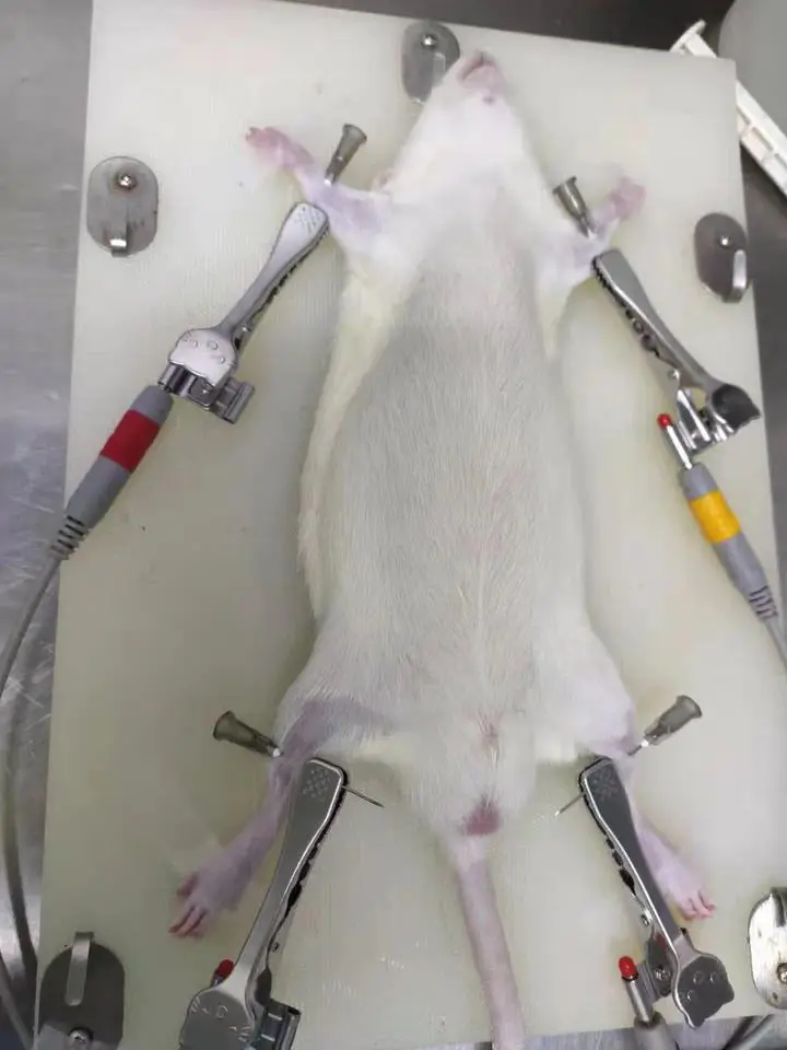 SUN-8032 Manufacturer High Quality 3 Channel 5 inch color screen Electrocardiograph Ecg Machine