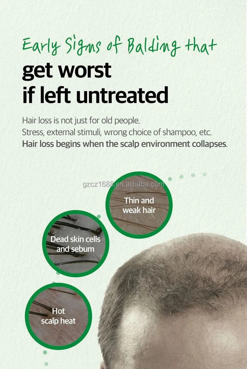 organic biotin anti loss wild natural private label products fast growth treatment oil serum Scalp Tonic spray for hair