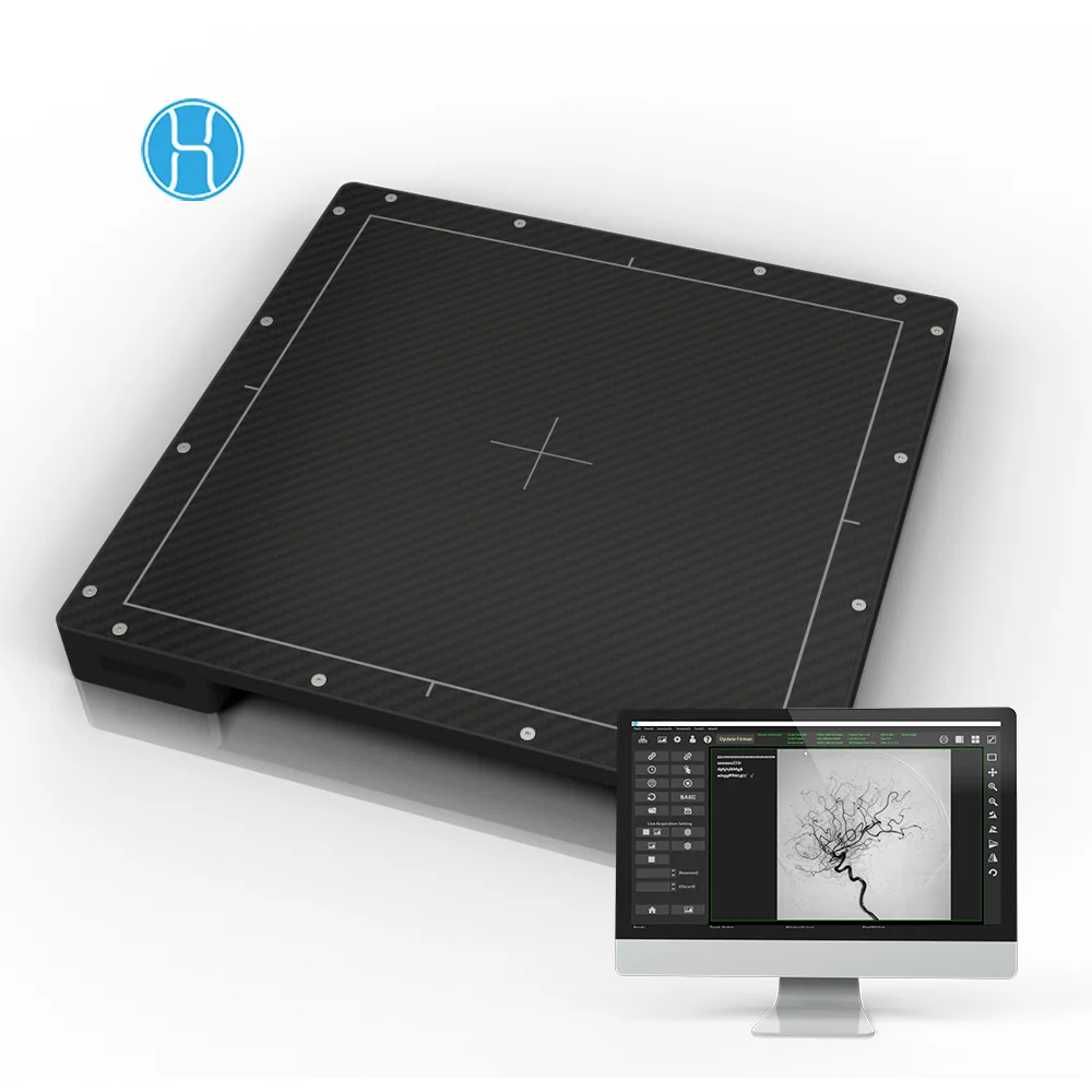 custom designed DR xray radiography Flat Panel Detector for Image intensifier replacement and upgrade