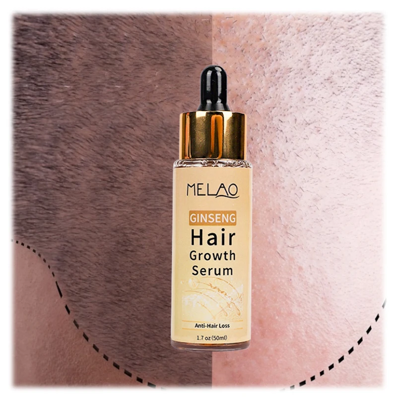 OEM 100% Pure Natural Organic Scalp Essential Oils Anti Hair Loss Product Ginseng Hair Growth Serum