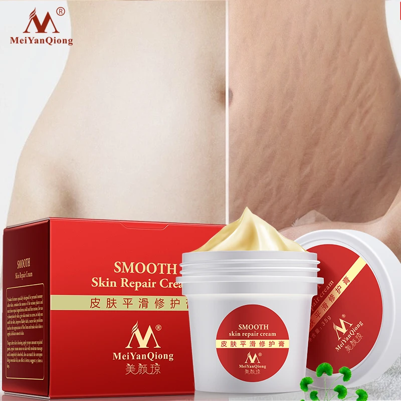 Body Skin Care stretch marks scar removal cream Maternity treatment Anti Vergeture Repair Stretch Mark Cream
