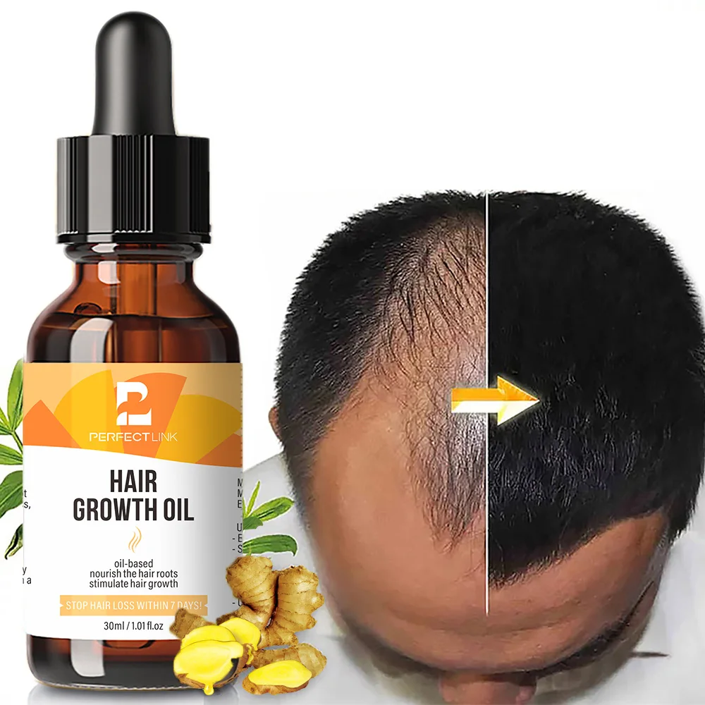 Wholesale New Arrival Hair Growth Oil with Biotin and Castor organic Hair Growth Serum For Woman