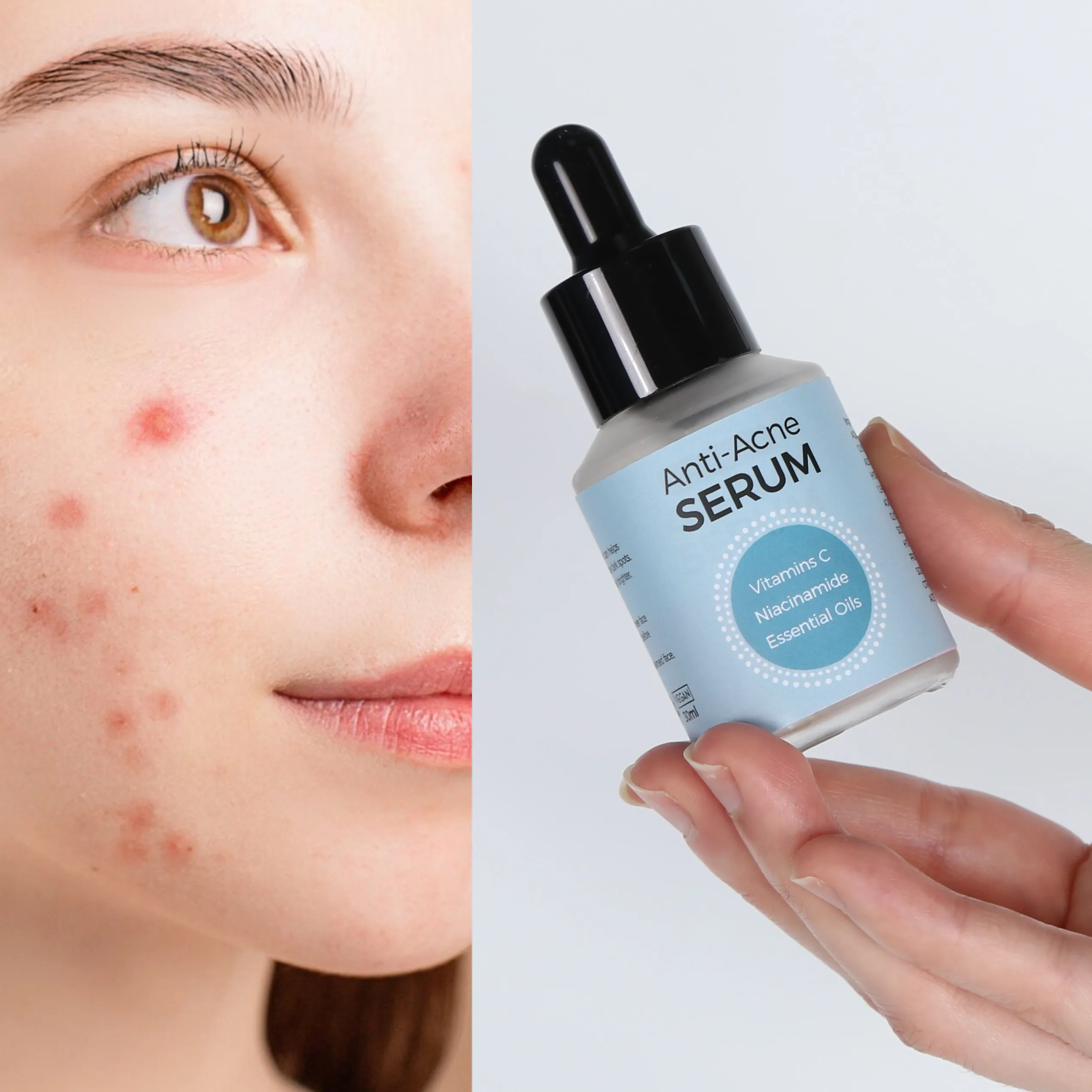 20% Vitamin C Retinol Tumeric Aloe Vera Facial Anti Acne Pore Serum Solutions 15 Ml