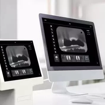 Dynamic Hot Imaging Success Rate 99% Sell Dental Equipment Dental Intraoral CR Imaging Plate Scanner