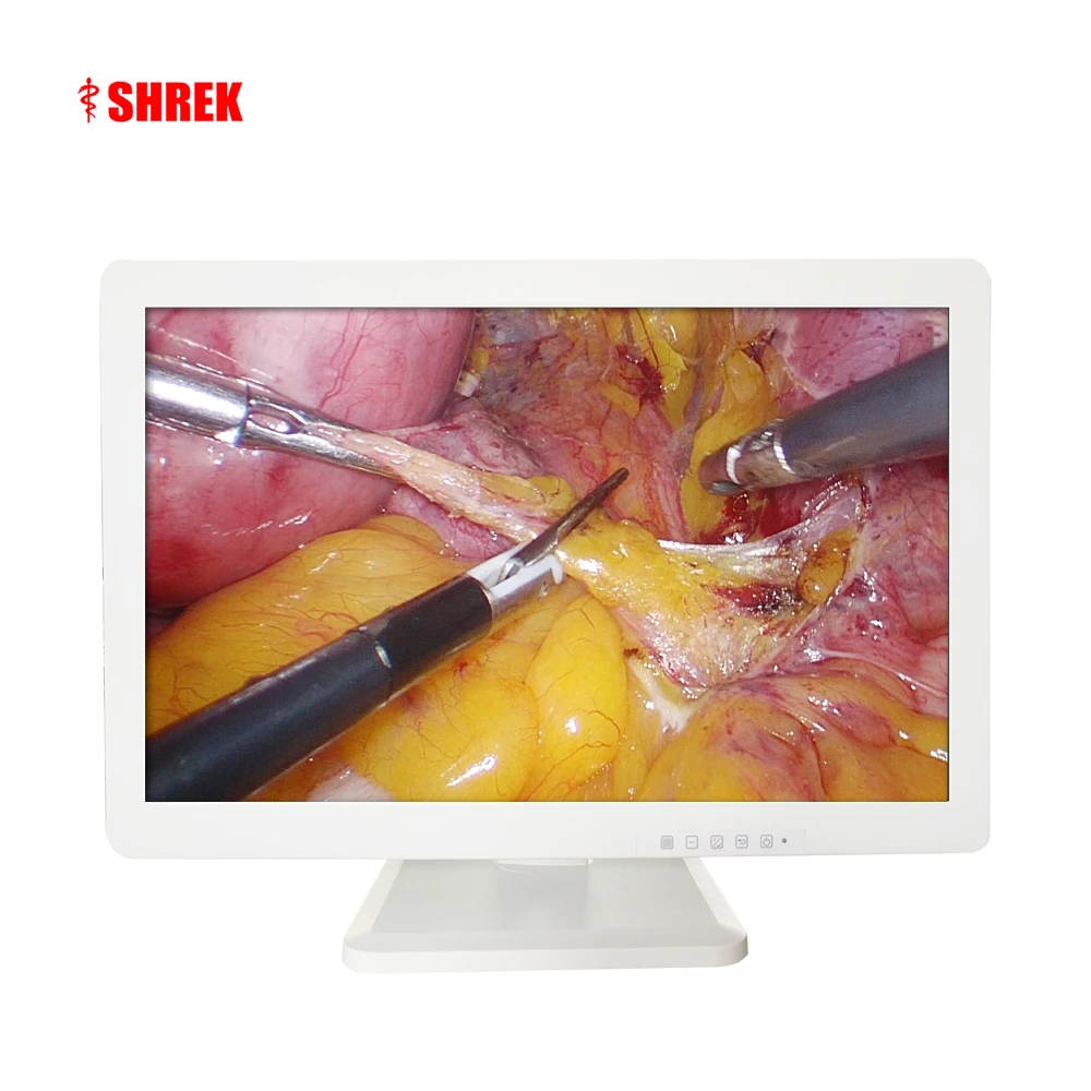 43 дюйма 4k медицинский монитор ценам от Шрек медицинская эндоскопическая
