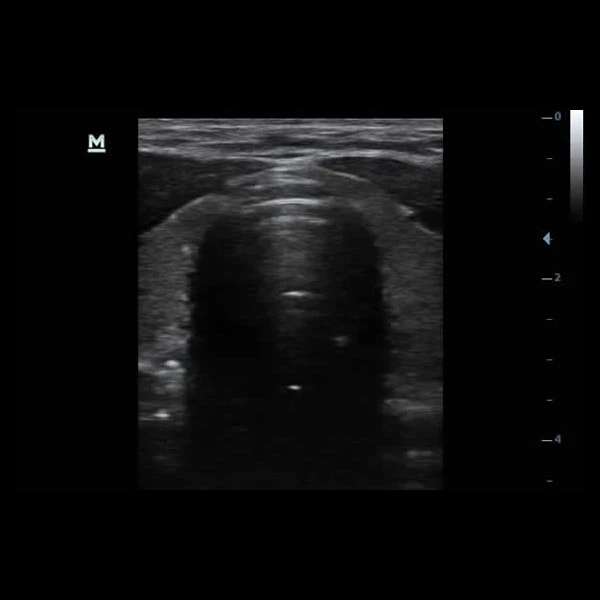 Portable Medical ultrasound instruments Human use Mindray DP10  Black and White  ultrasound machine price  veterinary Scanner