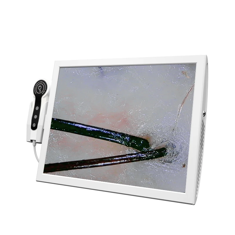 Face and Scalp Analyzer Skin Analyzer Professional Scalp detector HD salon