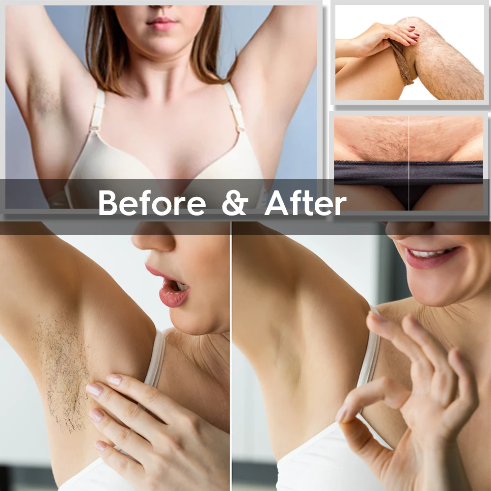 
Professional Mini Lady Face Epilator Depilator Depilador Epilation Depilacion Device Price Lazer Laser Ipl Hair Removal Machine 