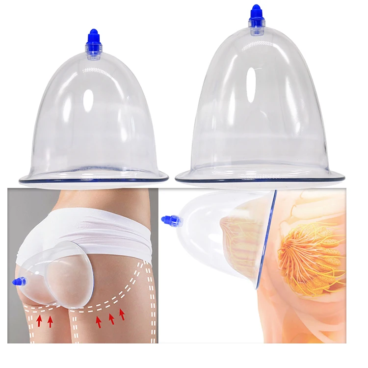 vacuum therapy cupping butt buttocks enlargement vacuum breast lift pumps cupping cups