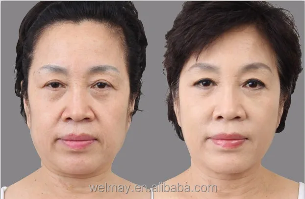 Beauty Machines New Technologies Inner Ball Roller Anti Cellulite Massager Lipo Laser Beauty Equipment Cavitation Machine