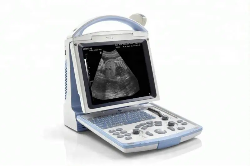 Mindray portable ultrasound machine DP-10 THI and 8-TGC assuring accurate image control